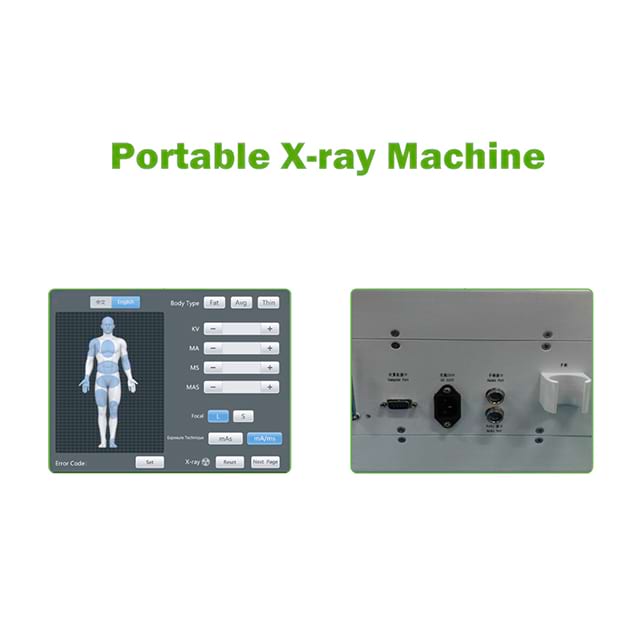 Machine à rayons X portable pour hôpital D019D-N